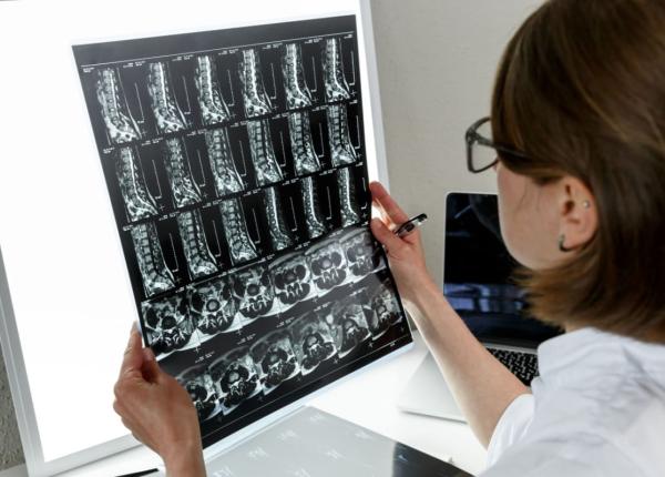 cum sa te pregatesti pentru un rmn al coloanei vertebrale