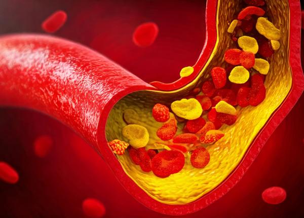 un fruct gras consumat zilnic timp de sase luni poate reduce colesterolul ridicat avocado