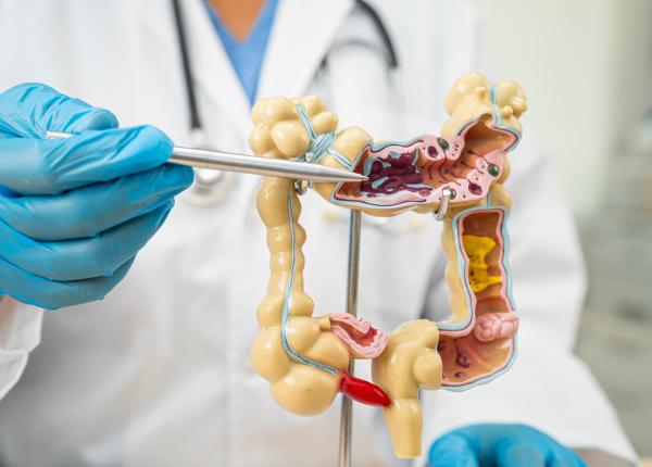 aceste doua bacterii localizate in cavitatea bucala cresc semnificativ riscul de cancer colorectal aceste doua bacterii localizate in cavitatea bucala cresc semnificativ riscul de cancer colorectal