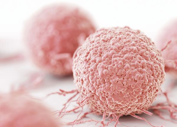 legatura dintre grasimi si cancerul de san triplu negativ legatura dintre grasimi si cancerul de san triplu negativ