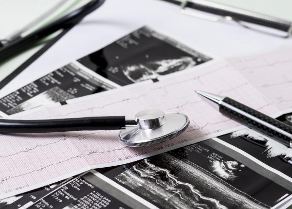 inteligenta artificiala poate prezice stopul cardiac cu pana la doua saptamani inainte de declansare inteligenta artificiala poate prezice stopul cardiac cu pana la doua saptamani inainte de declansare