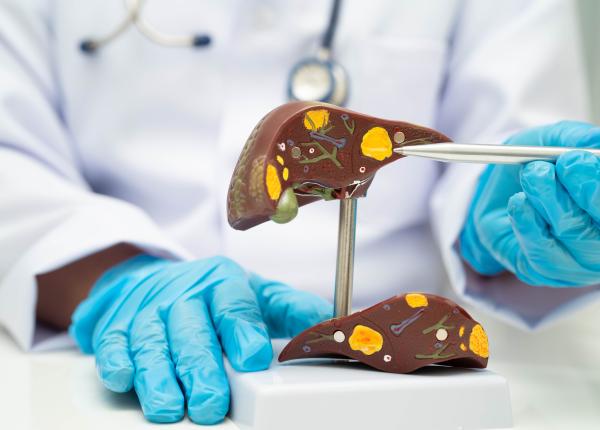 25 de ani de transplant hepatic in romania