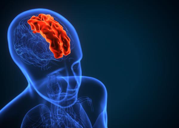 cum sa reduci riscul de accident vascular cerebral cu o simpla schimbare in dieta recomandata de un expert in nutritie cum sa reduci riscul de accident vascular cerebral cu o simpla schimbare in dieta recomandata de un expert in nutritie