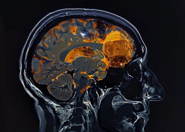 serotonina si mtor o combinatie care schimba tratamentele pentru depresie