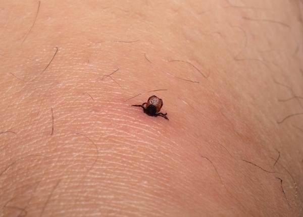 a inceput sezonul capuselor zeci de persoane au ajuns la spital in ultimele zile