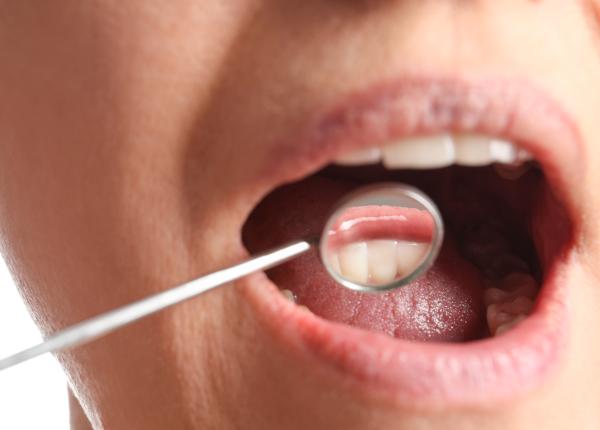 ti se retrag gingiile un simplu gest zilnic iti distruge dintii si gingiile adevarul pe care nu il spune nimeni ti se retrag gingiile un simplu gest zilnic iti distruge dintii si gingiile adevarul pe care nu il spune nimeni