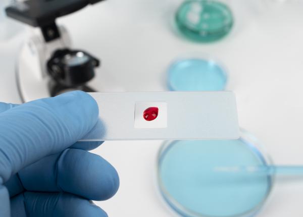 fda aproba primul test pentru depistarea cancerului de col uterin il poti face acasa