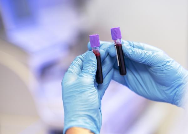 fda a aprobat primul test de sange pentru depistarea bolii alzheimer