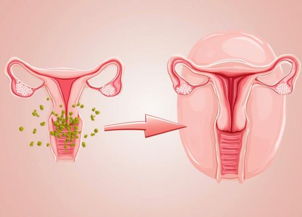 miros vaginal schimbat sau neobisnuit uite ce inseamna poate fi mai grav decat crezi miros vaginal schimbat sau neobisnuit uite ce inseamna poate fi mai grav decat crezi