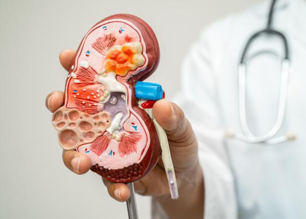 un obicei zilnic simplu protejeaza rinichii