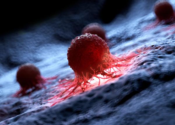 cancerul tacut care scapa la investigatia medicala apare in alta zona cancerul tacut care scapa la investigatia medicala apare in alta zona