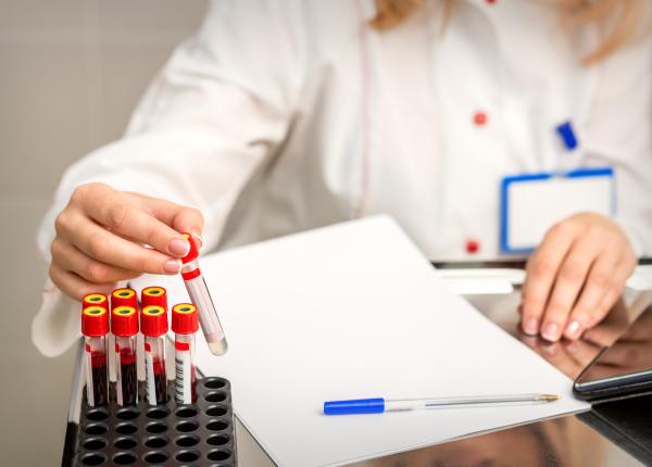 un simplu test iti poate prezice riscul de moarte