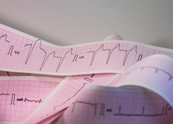 edemul periferic simptom cardiac ignorat de peste 50prc dintre pacienti edemul periferic simptom cardiac ignorat de peste 50prc dintre pacienti