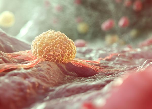 stevia si bacteriile probiotice potential tratament pentru cancerul pancreatic stevia si bacteriile probiotice potential tratament pentru cancerul pancreatic
