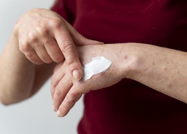 dermatita atopica nu e o forma de alergie dr alin nicolescu provoaca astm sau rinita dermatita atopica nu e o forma de alergie dr alin nicolescu provoaca astm sau rinita