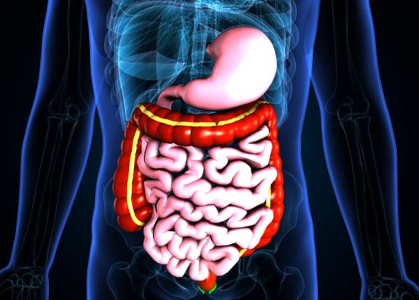 primul semn al cancerului de colon dr oana dolofan faci si ocluzie intestinala primul semn al cancerului de colon dr oana dolofan faci si ocluzie intestinala