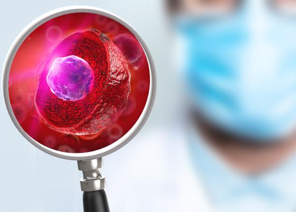cancer de prostata agresiv de ce nu trebuie sa te bazezi doar pe biopsie cancer de prostata agresiv de ce nu trebuie sa te bazezi doar pe biopsie