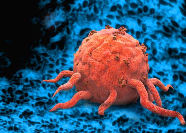 o gena poate face imunoterapia pentru cancer mai puternica ataca direct celulele canceroase o gena poate face imunoterapia pentru cancer mai puternica ataca direct celulele canceroase