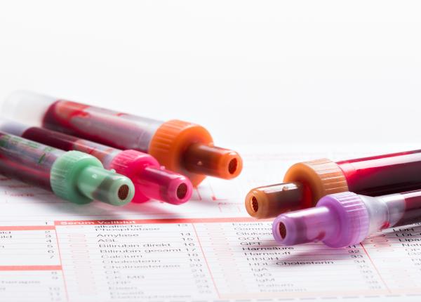 ce este o hemoleucograma si ce afectiuni poate detecta aceasta analiza de sange