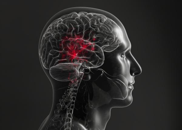 un fost ministru a facut avc in timpul unei emisiuni live cum recunosti semnele avc ului