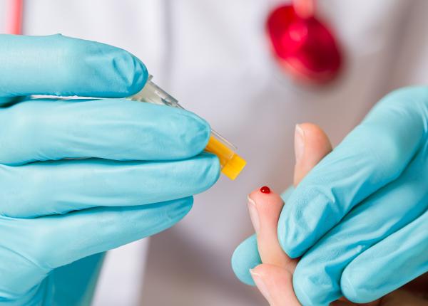 testul de sange care depisteaza cancerul ovarian in stadiu incipient testul de sange care depisteaza cancerul ovarian in stadiu incipient