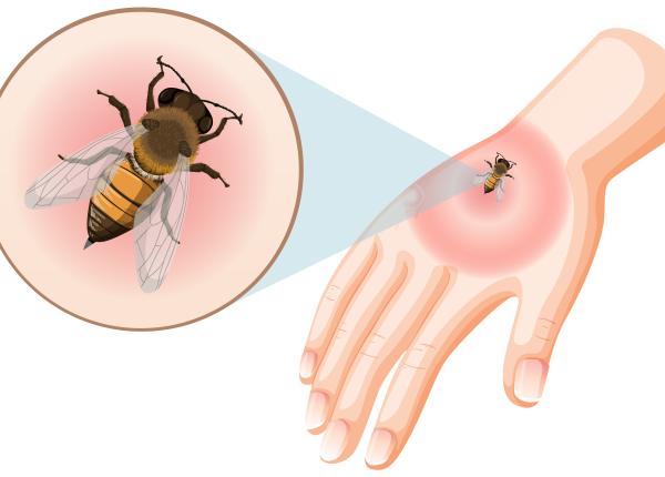 3 greseli banale care atrag albinele sa te intepe ciuhodaru nu bea asta inainte sa iesi din casa 3 greseli banale care atrag albinele sa te intepe ciuhodaru nu bea asta inainte sa iesi din casa