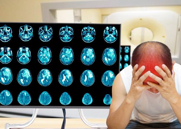 leziunile cerebrale cresc riscul de glioblastom ce simptome sa urmaresti leziunile cerebrale cresc riscul de glioblastom ce simptome sa urmaresti
