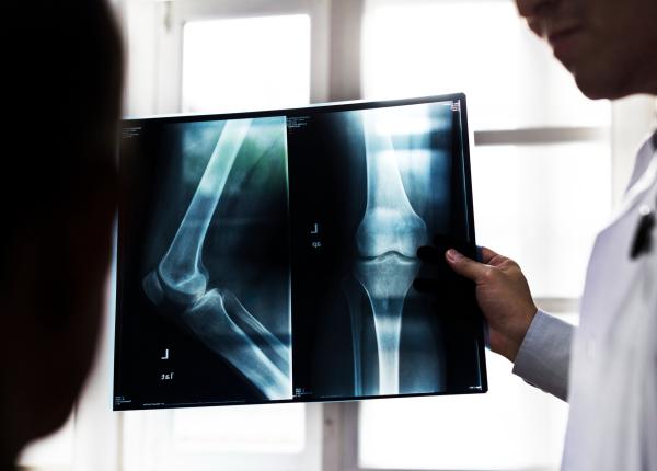 de ce radiografiile pentru genunchi pot fi periculoase in diagnosticarea osteoartritei de ce radiografiile pentru genunchi pot fi periculoase in diagnosticarea osteoartritei