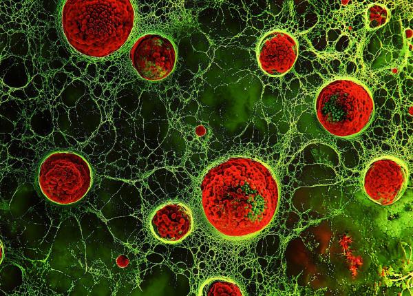 zeaxantina nutrientul vegetal care ar putea stimula lupta impotriva cancerului zeaxantina nutrientul vegetal care ar putea stimula lupta impotriva cancerului