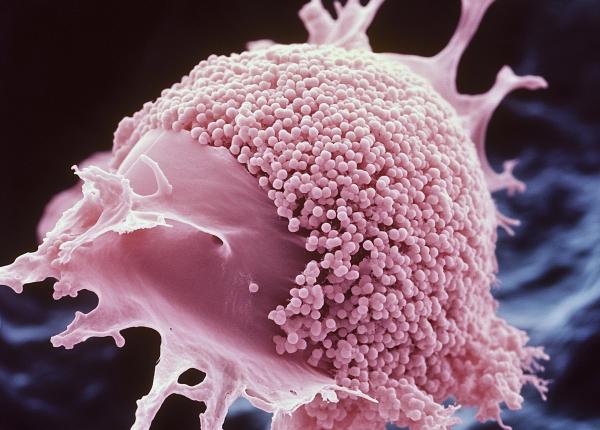 celulele latente care cauzeaza recidiva cancerului de san pot fi eliminate celulele latente care cauzeaza recidiva cancerului de san pot fi eliminate