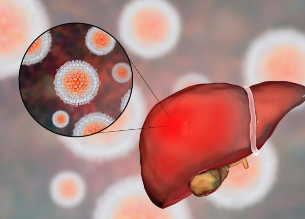 7 lucruri importante de stiut despre hepatita a un gest simplu distruge virusul 7 lucruri importante de stiut despre hepatita a un gest simplu distruge virusul