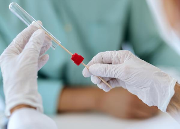 urina solutie promitatoare pentru depistarea cancerului de col uterin