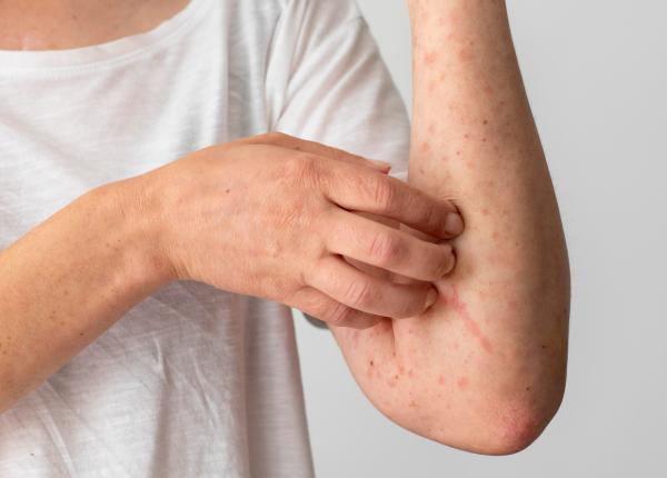 pneumonia si rujeola ucid copii in romania din cauza vaccinarii scazute prof dr doina plesca este ciudat pentru o tara europeana pneumonia si rujeola ucid copii in romania din cauza vaccinarii scazute prof dr doina plesca este ciudat pentru o tara europeana