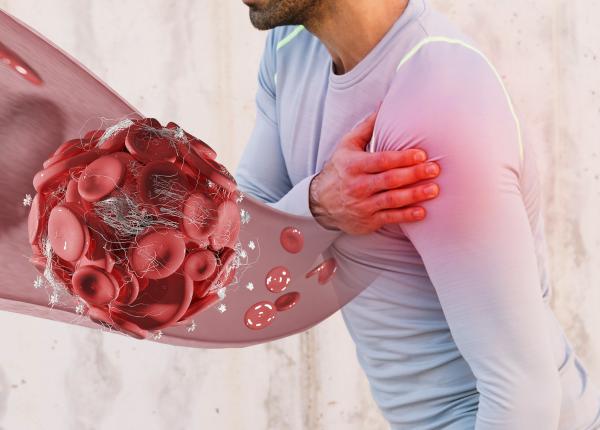 proteina c reactiva crp analiza care arata daca ai o inflamatie in corp proteina c reactiva crp analiza care arata daca ai o inflamatie in corp