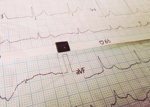 testul care iti arata din timp daca inima ta e in pericol inainte de aparitia simptomelor