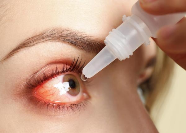 sindromul de ochi uscat o afectiune frecventa dar adesea ignorata