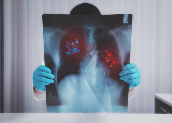 societatea romana de pneumologie 1 roman din 10 sufera de boala pulmonara obstructiva cronica