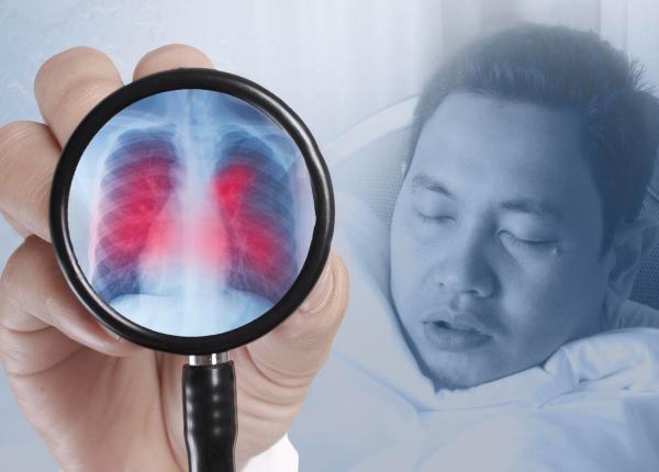 bronsita simptome la adulti si copii cauze si cand e contagioasa