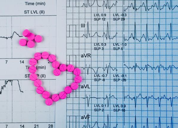 ce se intampla cu ritmul cardiac in timpul unui infarct