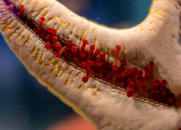 ce este mielofibroza simptome cauze si cum poate fi tratata