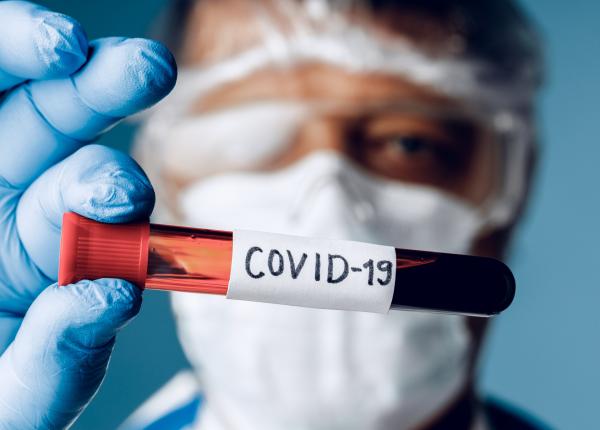 ce trebuie sa stii daca ai avut covid