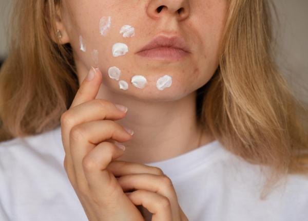 crema ta de fata s ar putea sa ti provoace ocluzie dr alin nicolescu despre greseala cu tenul uscat si tenul gras