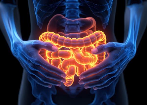 colonul rigid legat de un risc crescut de cancer precoce