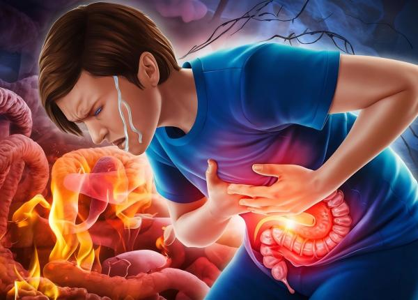 reflux gastroesofagian cauze simptome si preventia complicatiilor dr vlad simion sanador poate aparea cancerul