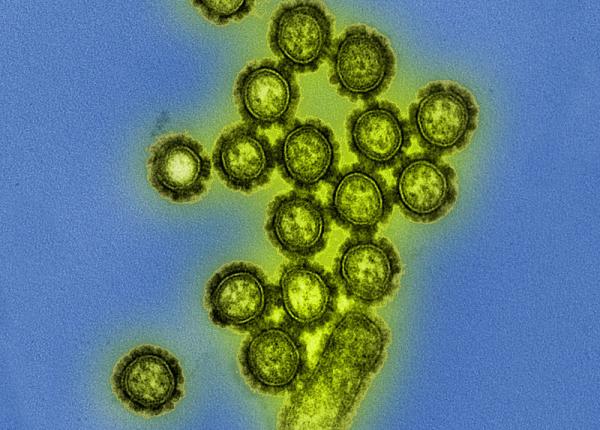 nu e covid dar pot fi la fel de periculoase doua virusuri despre care nu vorbeste nimeni