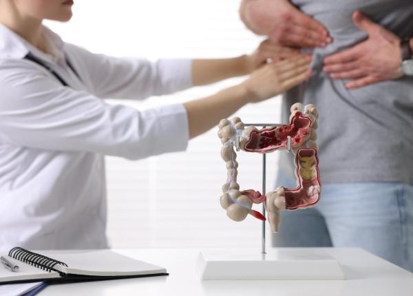 semnul din intestin care creste riscul de cancer colorectal