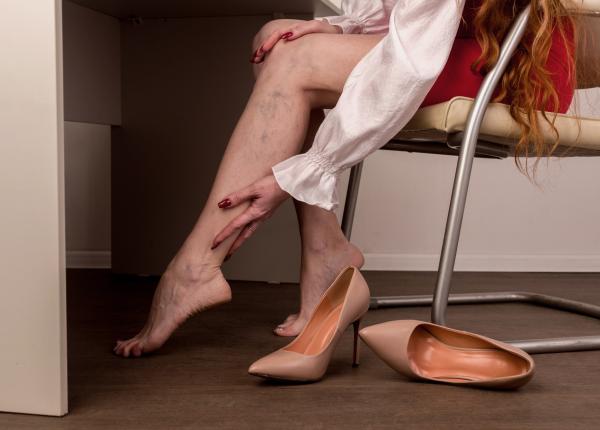 boala venoasa cronica simptome ignorate complicatii grave dr toni feodor 4 milioane de romani afectati