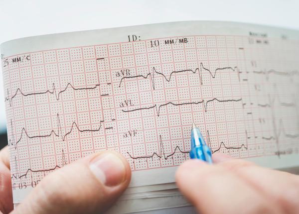 varsta la care ar trebui facut primul ekg prof dr victor costache explica