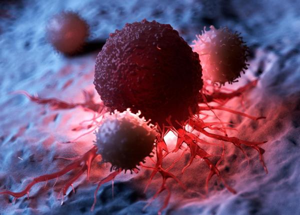 cancerul care se raspandeste in tacere inainte ca medicii sa l detecteze