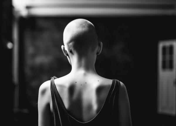 am aflat ca am cancer la creier la o petrecere semnul ciudat dat de menstruatie